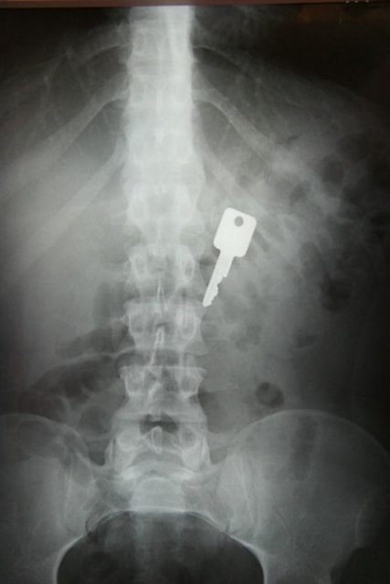 Anahtarını yutan adam böylelikle hiçbir zaman kaybetmiyor.