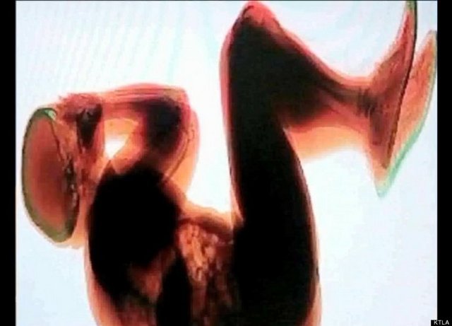 AKILALMAZ X-RAY GÖRÜNTÜLERİ! Roma Havaalanında bavul içinde saklanırken x-ray Cihazına yakalanan sarhoş adamın bavulun içindeki görüntüsü