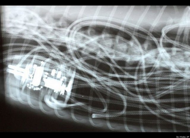 piton yılanının yuttuğu metal kablolar