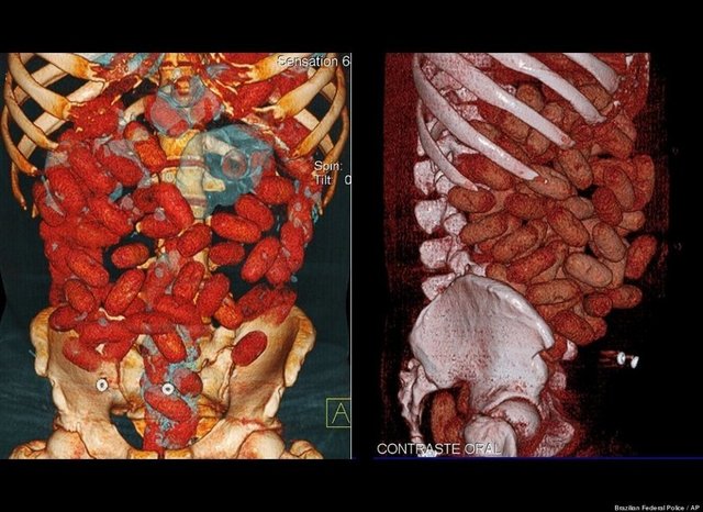 Brezilya havaalanında 830 gramlık 72 kapsul kokainle yakalandı.