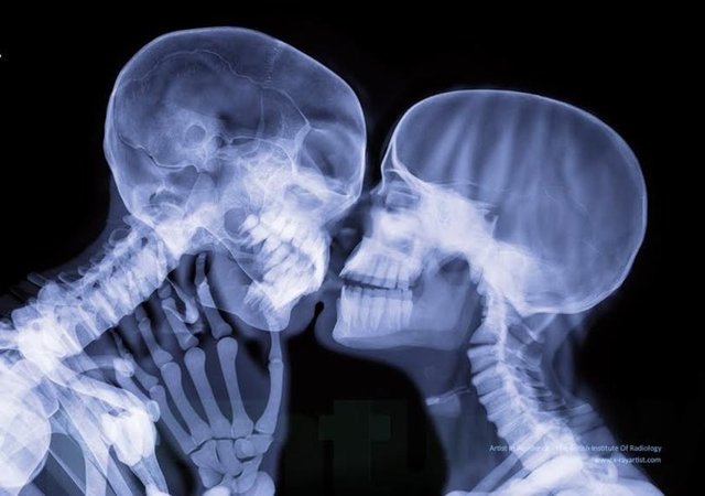 İki insan öpüşürken çekilmiş x-ray görüntüsü