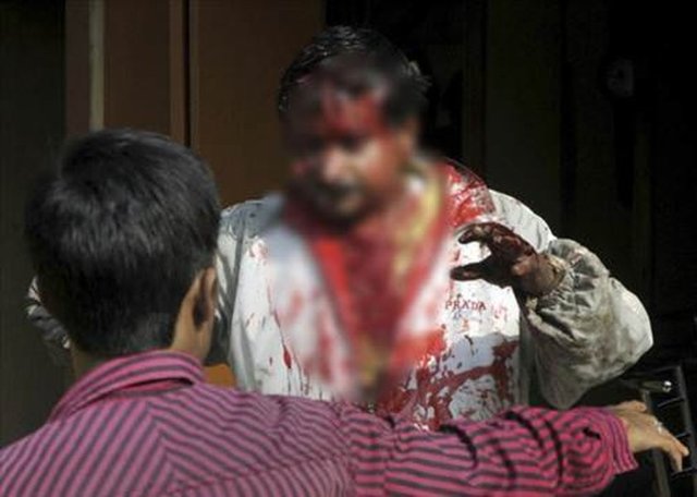 4 kişiye saldıran leopar insanları feci şekilde yaraladı.