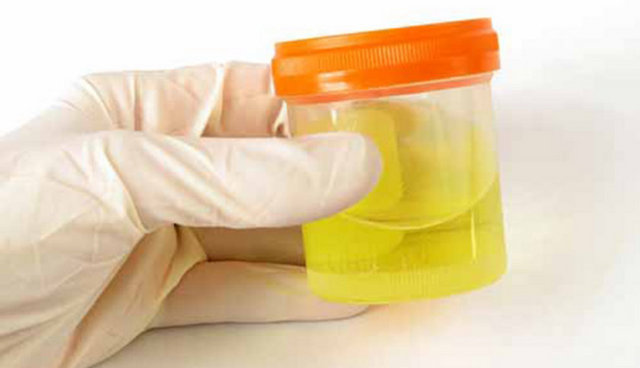 5) Oranlamayı öğrenin. Alkali olmak için besinleri seçerken iç ortamınızın asit oranına göre miktar belirleyin. Bunun için sabah ilk idrar pH'ını ölçün.