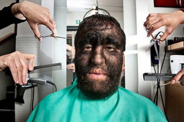 Guinness Rekorlar Kitabı'nda dünyanın en kıllı adamı olarak yer alan Gomez kardeşlerin vücutlarının yüzde 98'i kılla kaplı bulunuyor