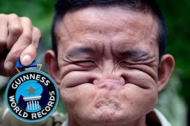 Çin'de yaşayan Tang Shuquan "Dünyanın en kıvrak yüzü" unvanını alarak Guinness Rekorlar Kitabı'na girdi. Shuquan burnunu ağzının içine alabiliyor. "Dünyanın en kıvrak yüzlü insanı" olan Shuquan madalya ve 10 bin dolar para kazandı. Dünyada kimsenin bu konuda onunla yarışamayacağını söyleyen Shuquan geçimini sokak gösterileri yaparak sağlıyor.