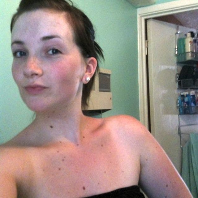 Ama ben hayattayken kanserin yaşamlarımızı sınırlamasını reddediyorum."  -