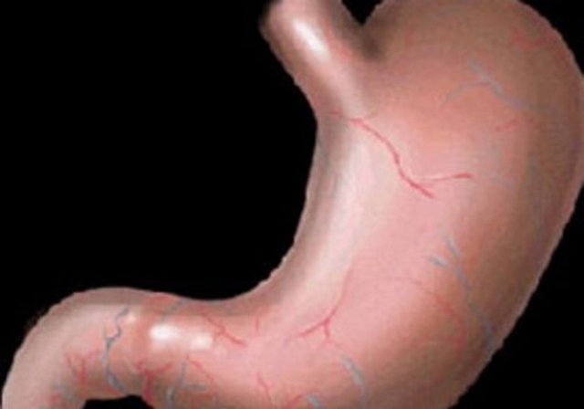 İnsan midesi 2 haftada bir iç zarını yenilemek zorundadır aksi halde kendi kendini sindirir.