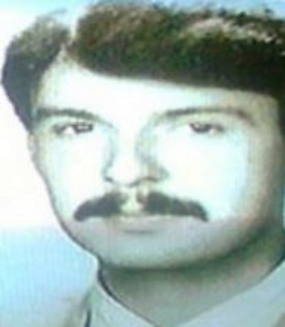 Aydın da estetik operasyon geçiren ünlülerden.