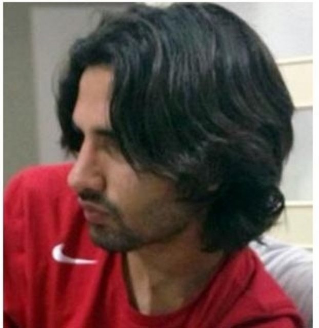 Burnundan devre arasında estetik operasyonu geçiren Potuk, yeni burnuyla böyle poz verdi.