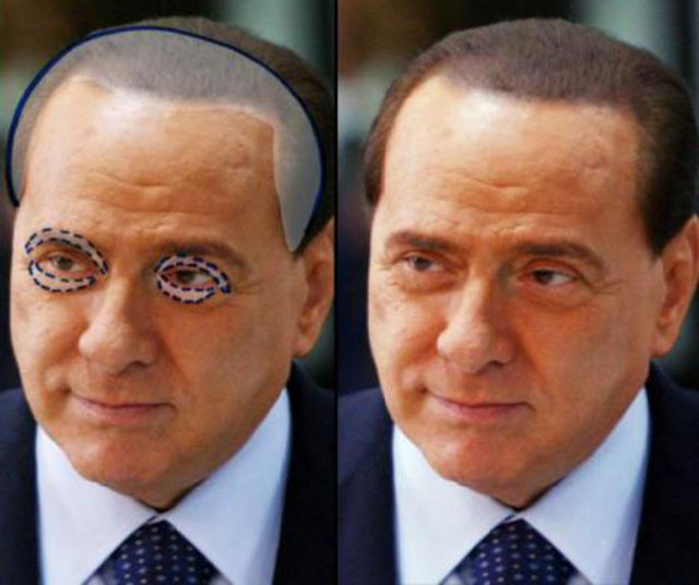 Berlusconi'nin Alın-boyun germe, kaş kaldırma, yüz gerdirme, saç ekimi, göğüs küçültme, et beni operasyonu ve cilt lekelerini temizletme gibi birçok estetik operasyon yaptırdığı biliniyor.