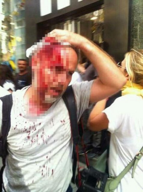 Simgeleşen kareyi çeken foto muhabiri Örsal, geçen Cuma günkü olaylarda başından yaralanmıştı.