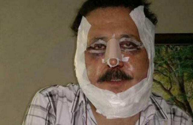 Güney kısa bir süre önce geçirdiği estetik operasyonla da basına haber olmuştu.  -