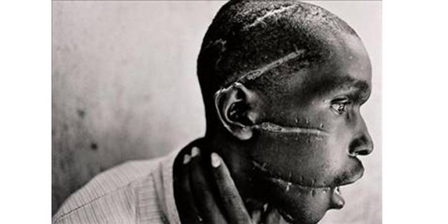 1994 James Nachtwey, ABD -  - Ruanda'da bu adam Tutsi isyancılarıyla konuştuğu gerekçesiyle askerler tarafından bu hale getirildi...