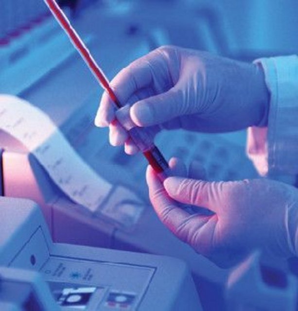 Bilim adamları, bu metabolitin kemik yoğunluğu, kolesterol seviyesi, tansiyon, akciğer fonksiyonu gibi anahtar konularda ipucu verdiğini ve