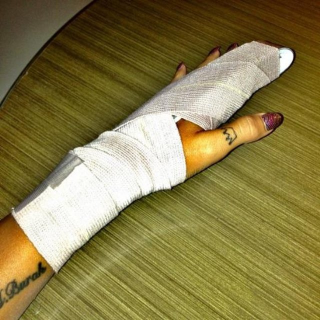 IŞIL REÇBER - Sonunda kendimi sakatladım 10 kg ağırlık düşerse -  -  -  -