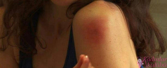 Yine ABD kaynaklı bir araştırmaya göre, sivrisinekler, dolunay zamanında, diğer zamanlarda olduklarından 500 kat daha hareketli oluyor.