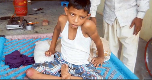 Hindu inancına sahip onbinlerce kişi kuyruklu çocuğu mutlu etmek ve duasını almak için yarışıyor. -