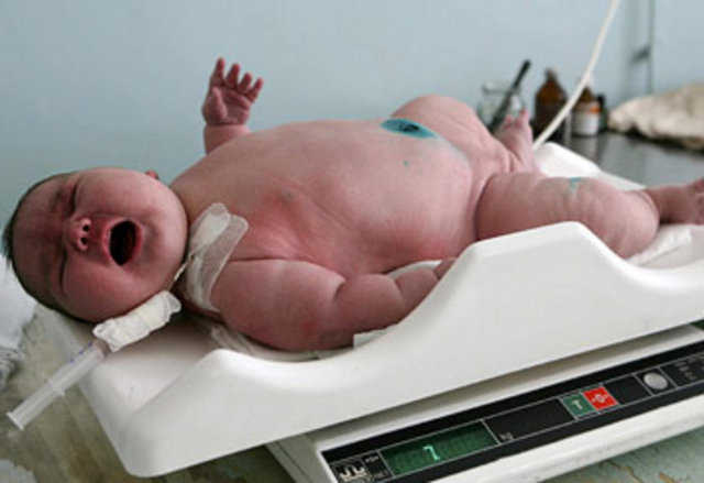 10.5 kilogram ağırlığındaki bebek sadece 11 saat yaşadı. -