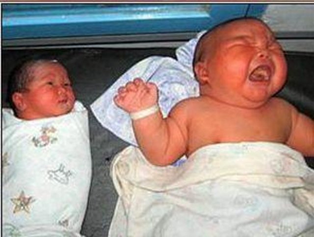 2005'te de Brezilya'da bir kadın, 8 kiloluk oğlunu sezaryenle dünyaya getirmişti.  -