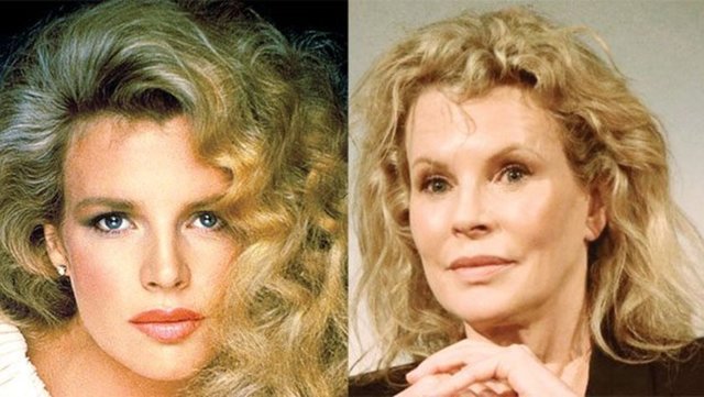 Başrolünde oynadığı 'The 11th Hour' isimli filmin tanıtımı için Los Angeles'ta düzenlenen basın toplantısında botokslu vyüzüyle dikkat çekti.