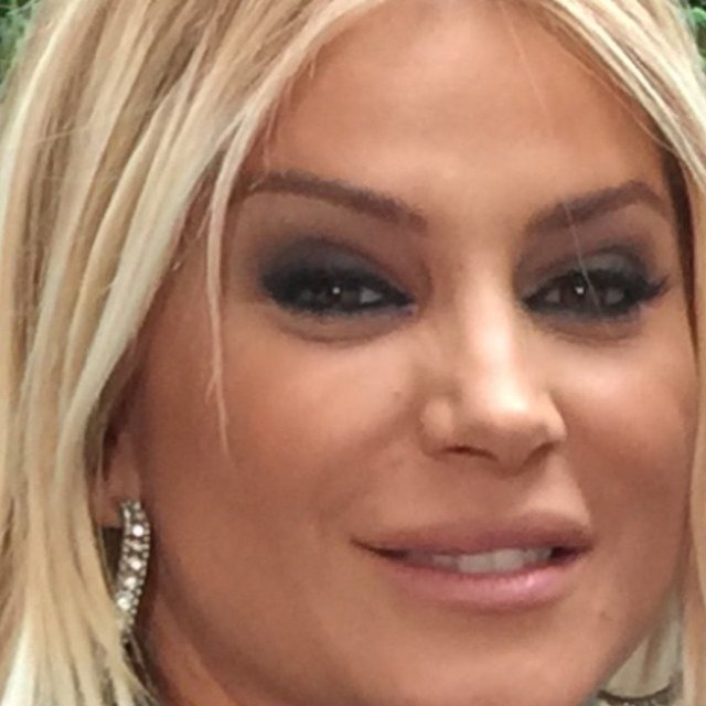 Ünlü şarkıcı, yaptırdığı estetik operasyonu göstermek için aynı fotoğrafları yakınlaştırarak 3 kez paylaştı.