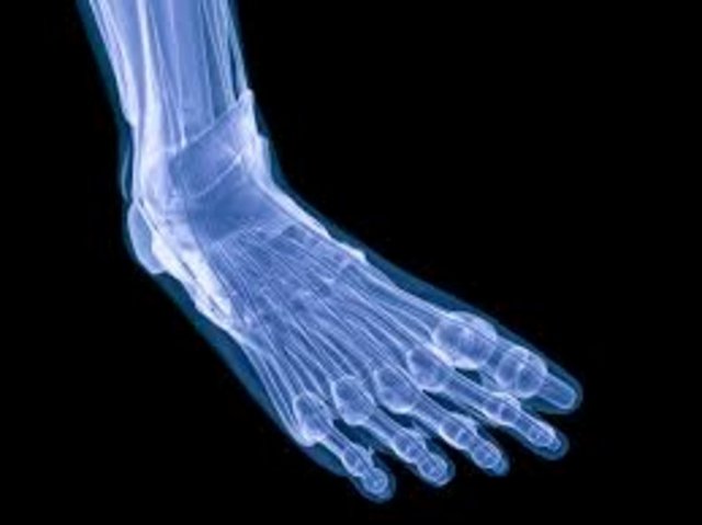 1- Aşırı baskı acıya neden oluyor -