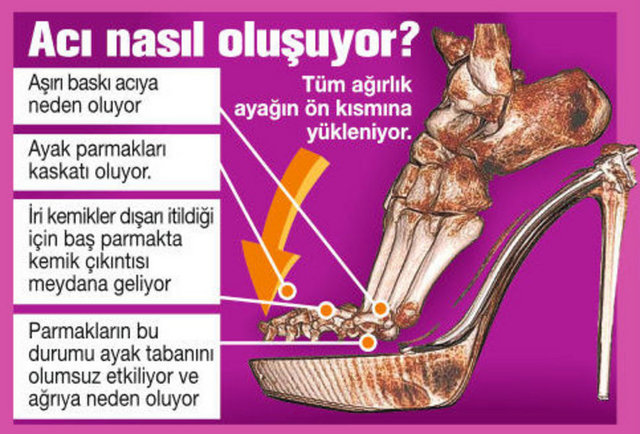 2- Ayak parmakları kaskatı oluyor. -