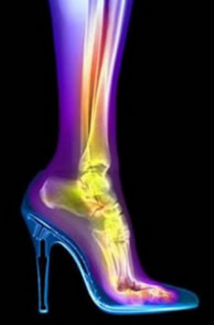 Topuk ne kadar inceyse zararı o kadar büyük oluyor" dedi. -