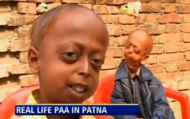 Hastalığıyla ilgili konuşan minik hasta "Umarım benim durumumdakiler için bir ilaç vardır. Ben gerçekten yaşamak istiyorum. Ölümden korkmuyorum ama ailemin daha fazla acı çekmesini istemiyorum. Onlar için daha uzun yaşamak isterim" diyor.