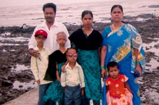 Ali ise yaşama olan bağlılığıyla doktorların umudu oldu.