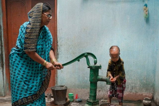 Ali'nin gözlerinde ve kalbindeki sağlık sorunlarının yanı sıra saçları da çıkmıyor.
