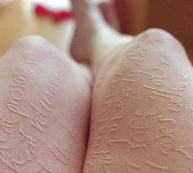 New York'ta yaşayan Ariana Page Russel, nadir görülen bir deri hastalığına sahip.