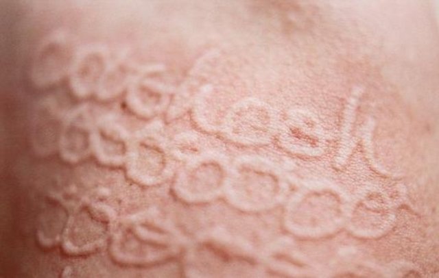 Keskin olmayan uçlu bir şişle vücudunda desenler yaratan genç kadının sergisi büyük ilgi görüyor.