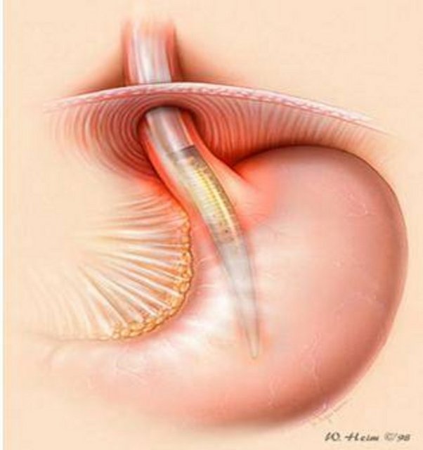 Ancak nikotin, hücrelerin yenilenmesini ağırlaştırıyor.