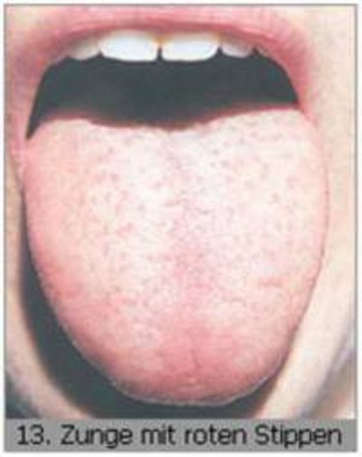 DİL KENDİSİNİ 10 GÜNDE YENİLİYOR -  - Tat moleküllerini sinirler yoluyla beyne ileten dilde bulunan 10 bin tomurcuğun her birinde 50 hücre bulunuyor.