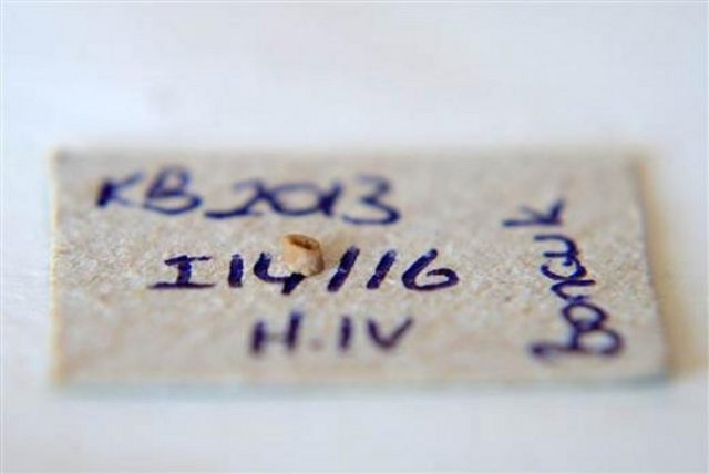 - "Gözle görmenin neredeyse mümkün olmadığı boncuk taneleri çok detaylı bir çalışma sonucunda ortaya çıkarıldı. Süslenme, Yontma Taş Devri, bilimsel adıyla Paleolitik Çağ'da, yani günümüzden 40-45 bin yıl önce başlıyor. Süslenme objeleri hem kişisel görünüm hem de ritüel amaçlı kullanılıyor. Bulduğumuz boncuklar, Kalkolitik (Bakır Taş Çağı) ve Neolitik (Yeni Cilalı Taş) dönemlerine ait. Bunları tıpkı pirinç ayıklar gibi ayıkladık. Normal şartlarda bu kadar küçük boncukları görmek mümkün değil."