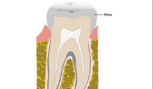 Diş minesi insan vücudundaki en sert madde.