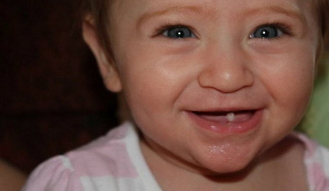 Her bin bebekten biri tek dişle doğuyor.