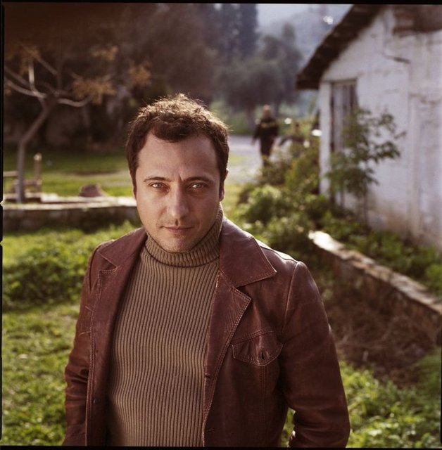 Saçlarının yanları ve üstleri seyrek olan yakışıklı oyuncunun saç ektirdiği...