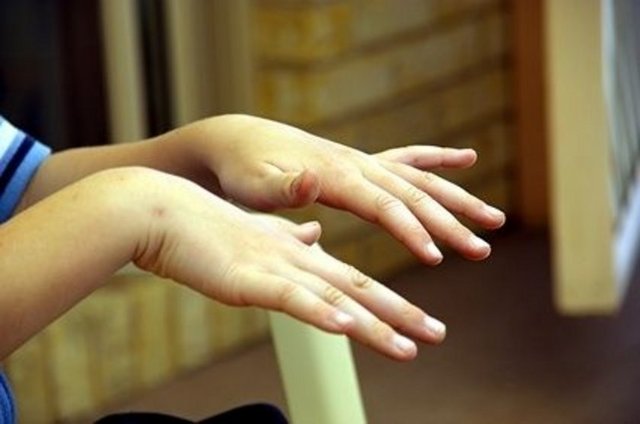 Faydaları: Titremeleri önlemede ve damar tıkanıklığının giderilmesinde yardımcı olur. -