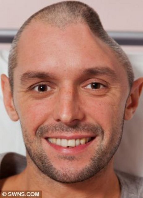 İngiltere'deki doktorlar kafatasını yeniden kullanmasına yardımcı olacaklarını söyleyince, Charlie de kafatası parçasını bavuluna koyarak ülkesine döndü. -