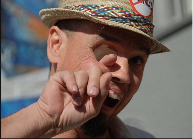 Owen hayata döndü ama eskiden sağ gözünün bulunduğu yerde şimdi kocaman bir boşluk var. -  -    -