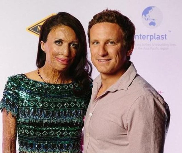 Onu yıllardır tanıyorum ve kendimi bildim bileli evlilik hakkında konuşuyoruz ve sonunda sürpriz bir teklifte bulundu." Çift şimdi evlilik hazırlıkları yapıyor.