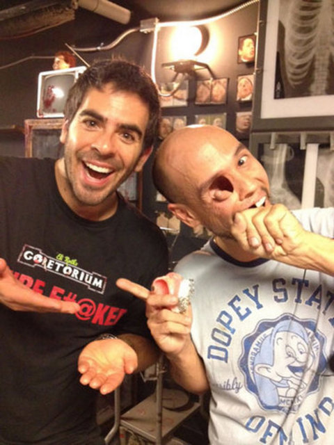 Owen geçtiğimiz günlerde Freakshow adlı programa katıldı ve milyonlarca kişinin dikkatini çekti. -  -  - Programın sunucusu Todd Ray, "Billy'yi öyle gözü ve göz yuvası olmadan karşımda gördüğümde şok oldum. Ama hikayesi çok dokunaklı ve izleyen herkes bundan çok etkilediğini söyledi" diye konuştu.