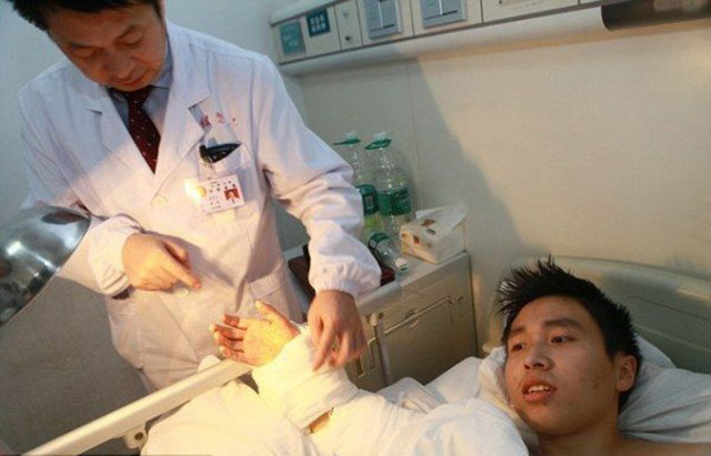 1 ay süreyle burada iyileşmesi beklenen el önceki gün başarılı bir operasyonla tekrar kola dikildi.