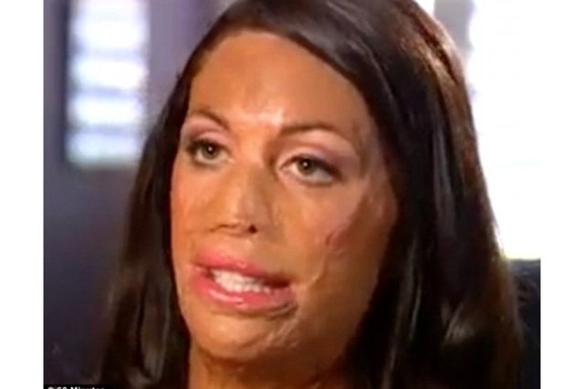 bir yardım kuruluşuna bağış toplayabilmek için yollara düştü. Kadınlardan oluşan 22 kişilik bir ekiple sekiz gün boyunca 95 kilometre yürüyerek Çin Seddi'ne tırmandı. Pitt ekibi ile birlikte 200 bin dolar bağış toplamayı başardı.