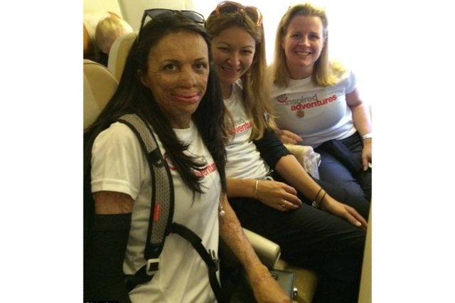 tırmanarak topladığı bağışla tüm dünyaya ilham vermeye devam ediyor. 2011'de yaşadığı elim kaza sonrası hayata sıkı sıkıya tutunan 26 yaşındaki Pitt gelişmiş ülkelerde ihtiyacı olan insanların estetik ameliyat olabilmelerine olanak sağlayan...