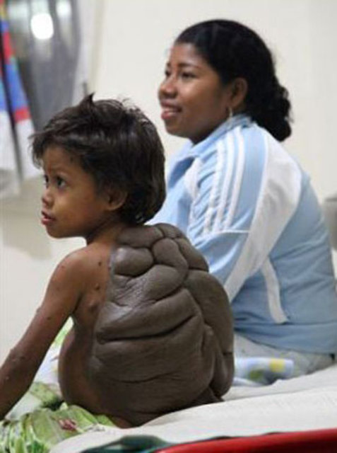 DOKTORLARI ŞOKE EDEN GÖRÜNTÜ8 yaşındaki Didier Montalvo hayatında ilk kez büyük bir olay için Kolombiya'dan İngiltere'ye gitmek için uçağa bindi...