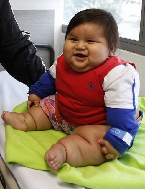 Kolombiya'nın en şişman bebeği olarak bilinen 8 aylık Santiago Mendoza, 6 yaşındaki bir çocuğun ağırlığında. 19.7 kiloluk bebek, başkent Bogota'daki bir klinikte obezite tedavisi olacak.