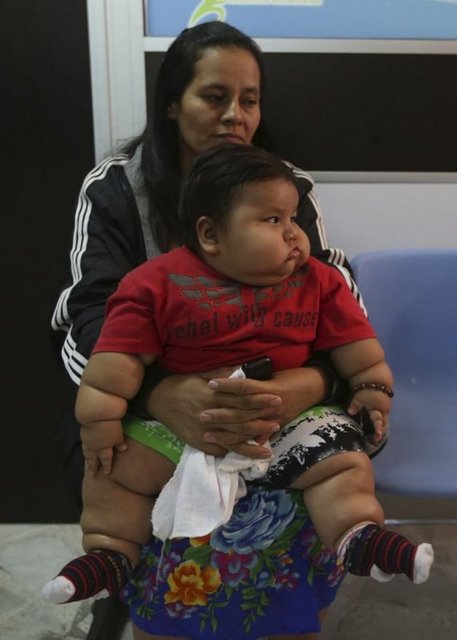 Medellin kentinde kurulan Obezite Kalp Vakfı yetkilileri minik Santiago'nun yardımına koşarak, onun tedavisi için gerekli olan parayı topladı.